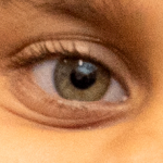 Trachoma no longer a public health problem