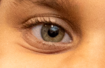 Trachoma no longer a public health problem